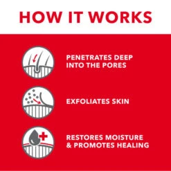 TropiClean OxyMed Medicated Anti-Itch Conditioning Treatment For Pets -Peticlean Shop ivhvdqmgzkuth94ipqba